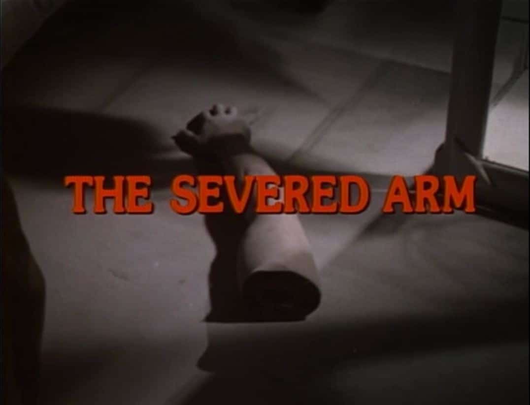The Severed Arm