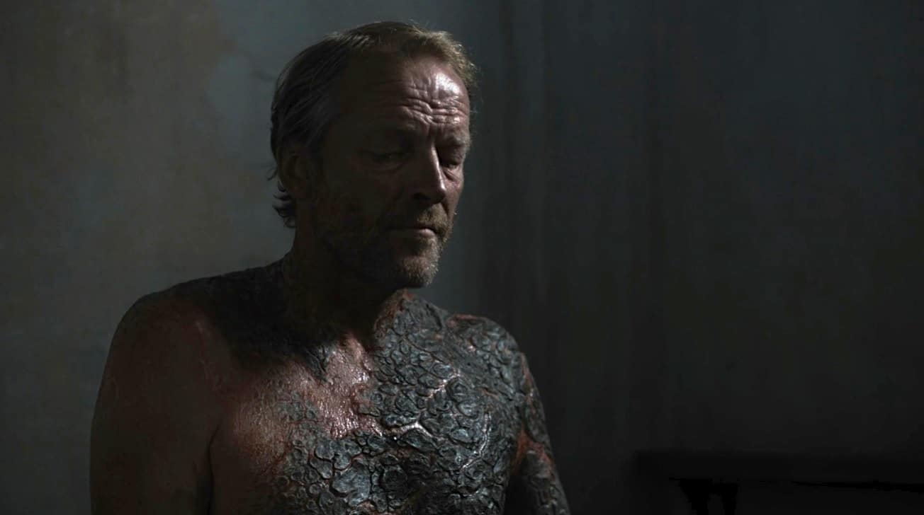 Game of Thrones Greyscale Disease